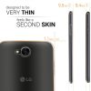 LG X Power 2 tok, szilikon, átlátszó, 41194.03
